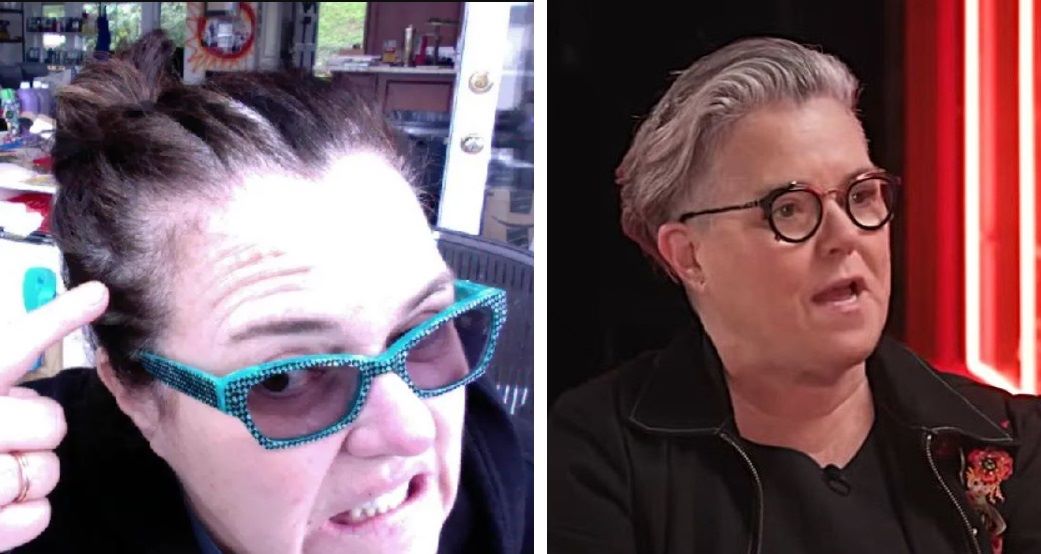 Rosie O'Donnell hair loss