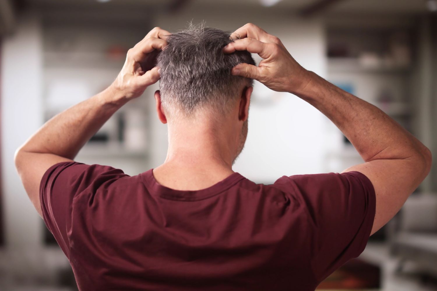 Scalp problems can cause hair loss