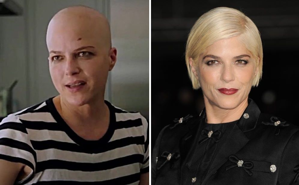 Selma Blair bald due to chemotherapy (left) and with hair (right)