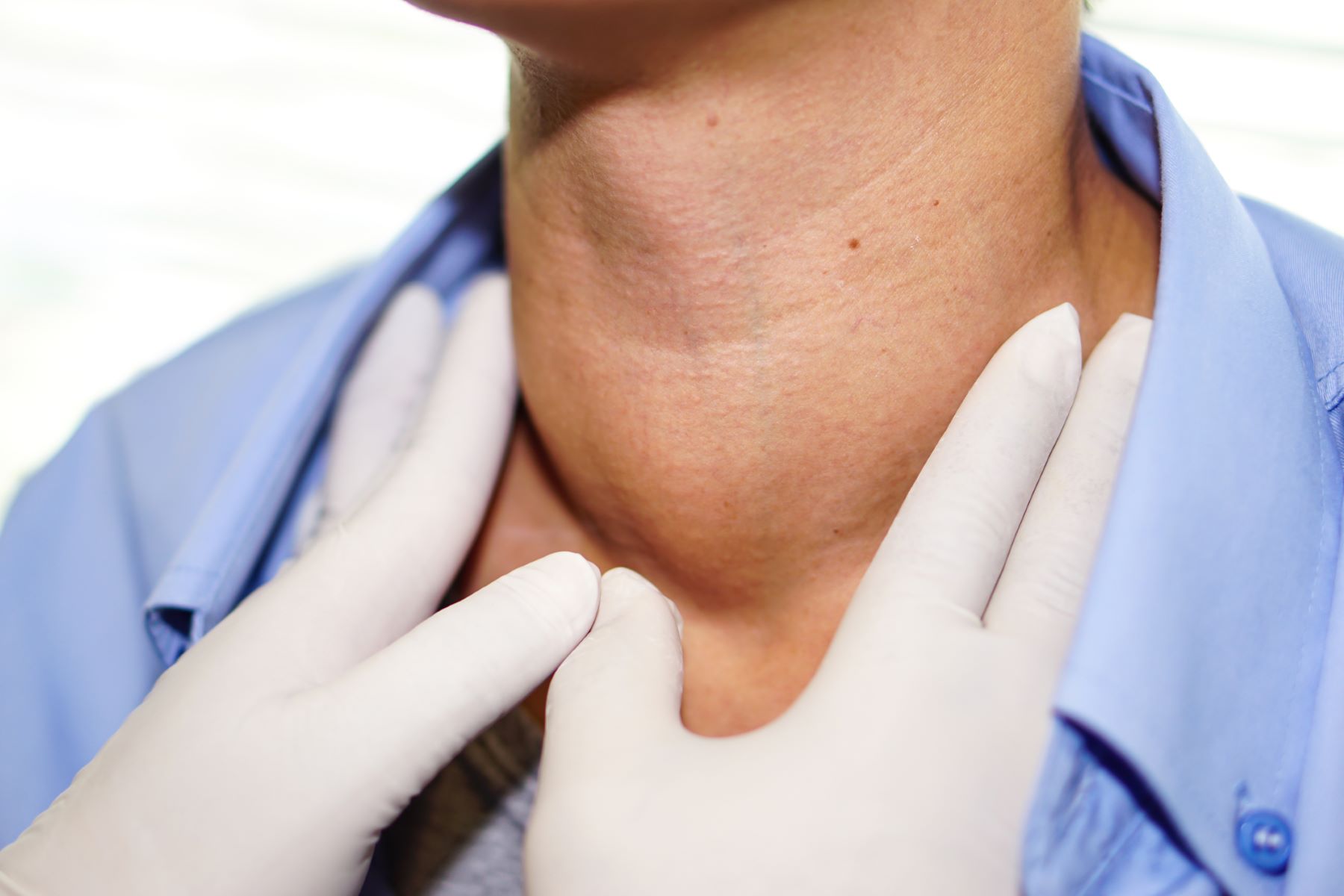 Thyroid problems can cause hair loss