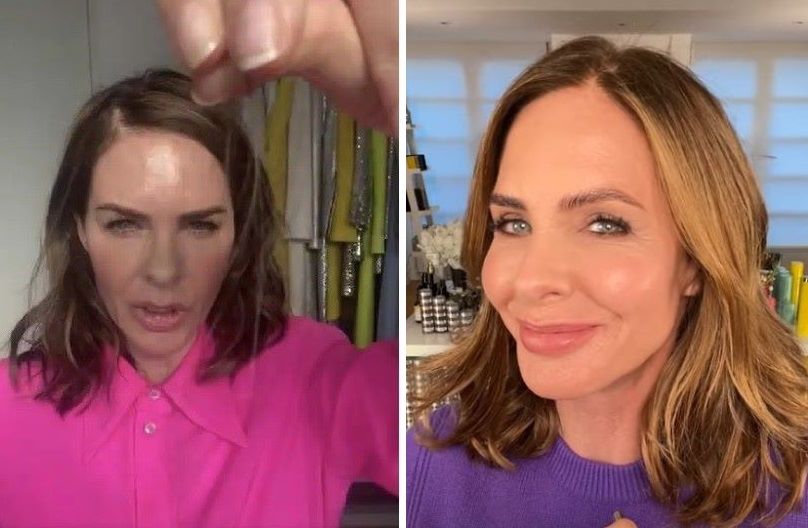 Trinny Woodall hair loss