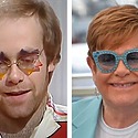 Elton John Hair Transplant: Everything You Need To Know