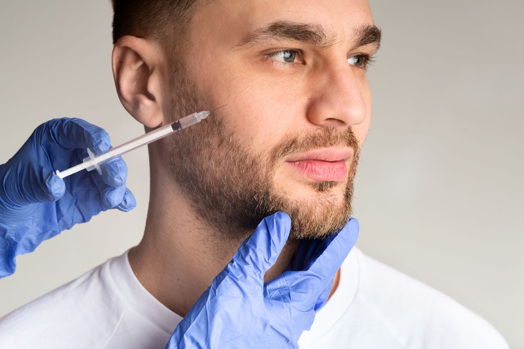 PRP combined with Minoxidil for beard growth