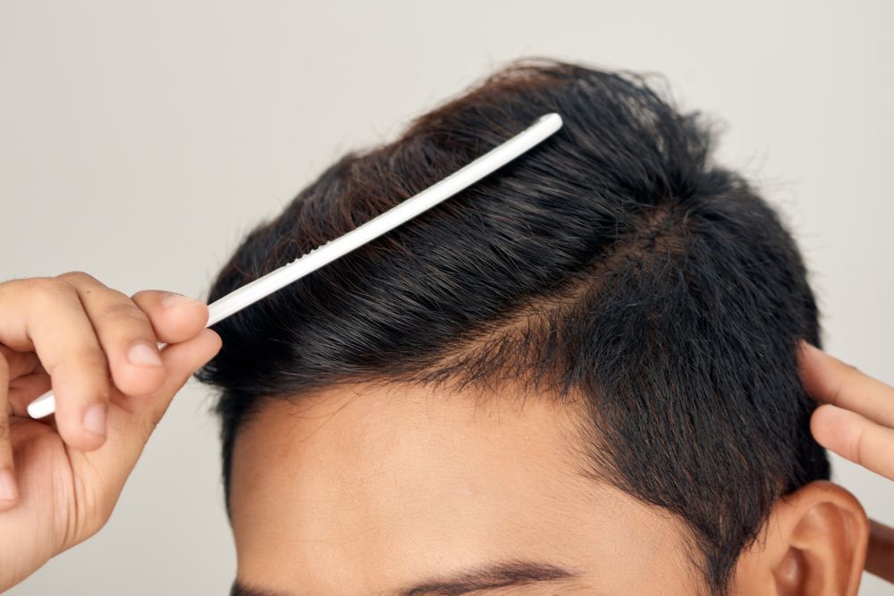 Can A Hair Transplant Increase Hair Density? | Wimpole Clinic