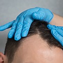Temple Hair Loss: How To Prevent, Treat & Regrow Temples