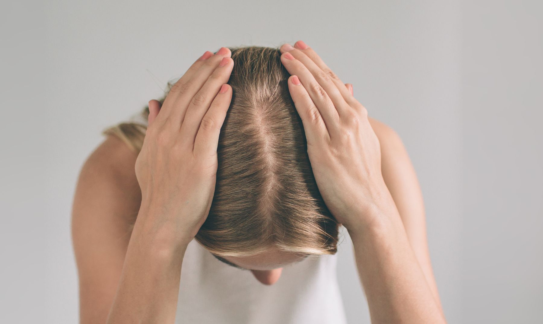 Why am I experiencing hair loss after stopping birth control?