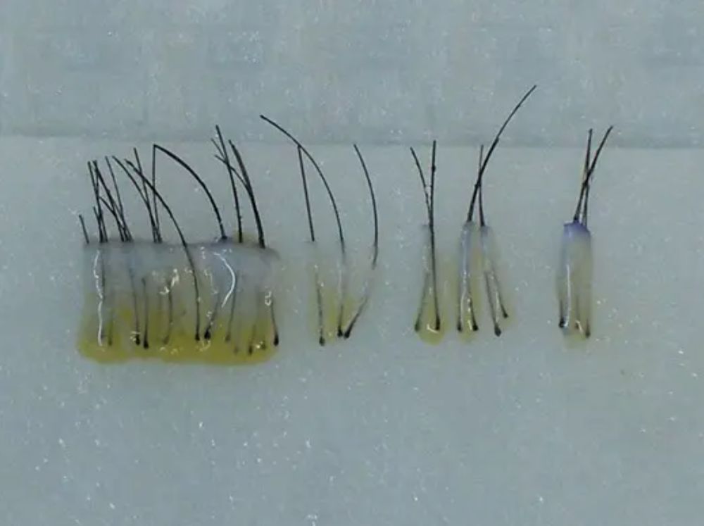 Extracted hair grafts