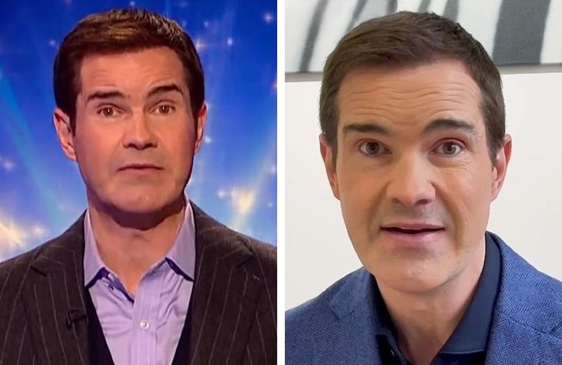 Jimmy Carr's hairline in 2021 (left) and 2022 (right)