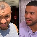 Jonathan Joseph Hair Transplant: Everything You Need To Know