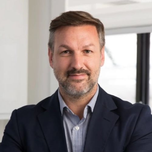 Results of James Walton’s hair transplant at the Wimpole Clinic