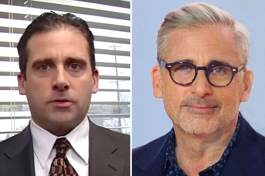 Steve Carell Hair Transplant