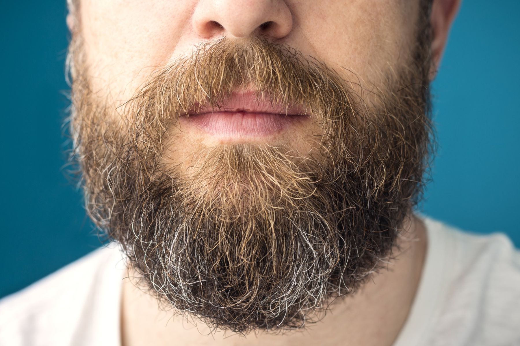 beard hair can be used in a hair transplant if you are completely bald