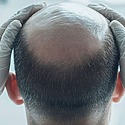 How Much Does A Crown Transplant Cost?