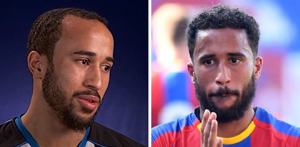 Andros Townsend with a receding hairline (left) and straight hairline (right)