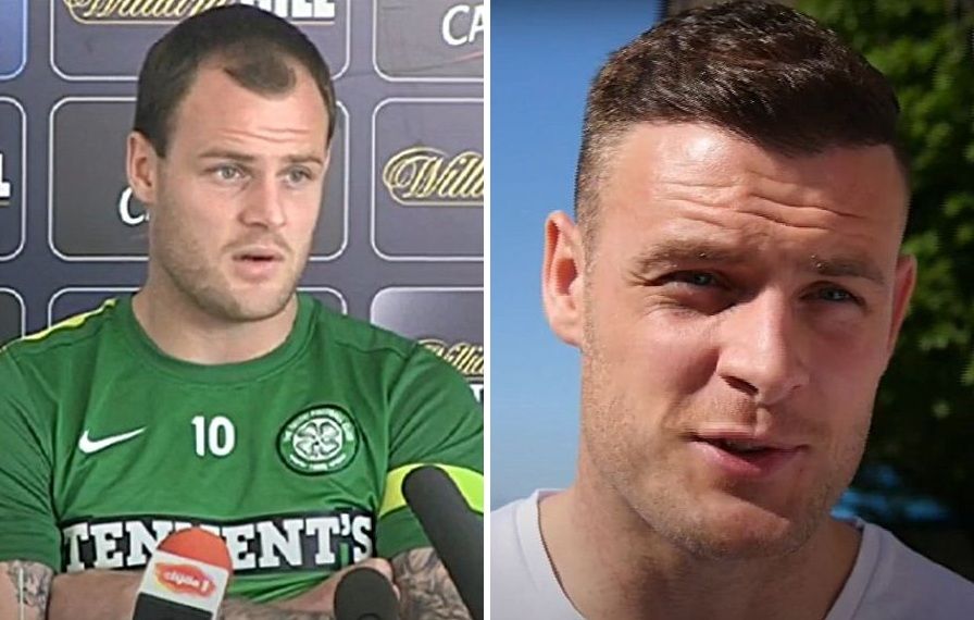 Anthony Stokes hair transplant