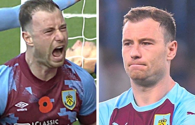 Ashley Barnes before and after hair transplant