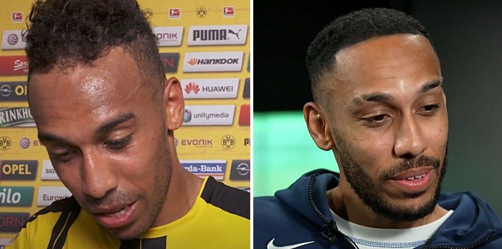 Aubameyang hair transplant