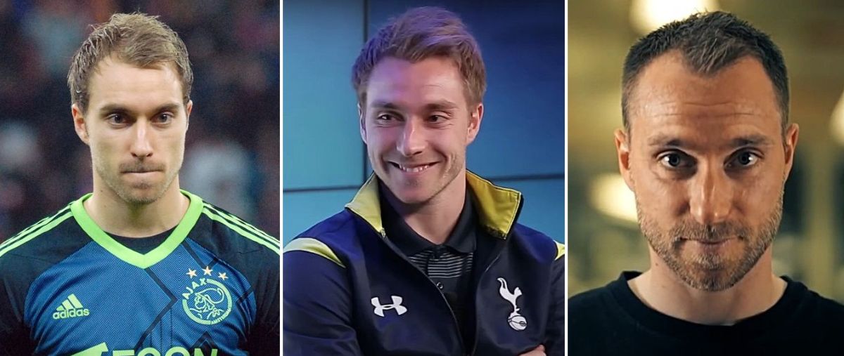 Christian Eriksen hair transplant