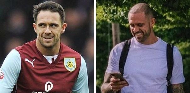 Danny Ings hair transplant before and after