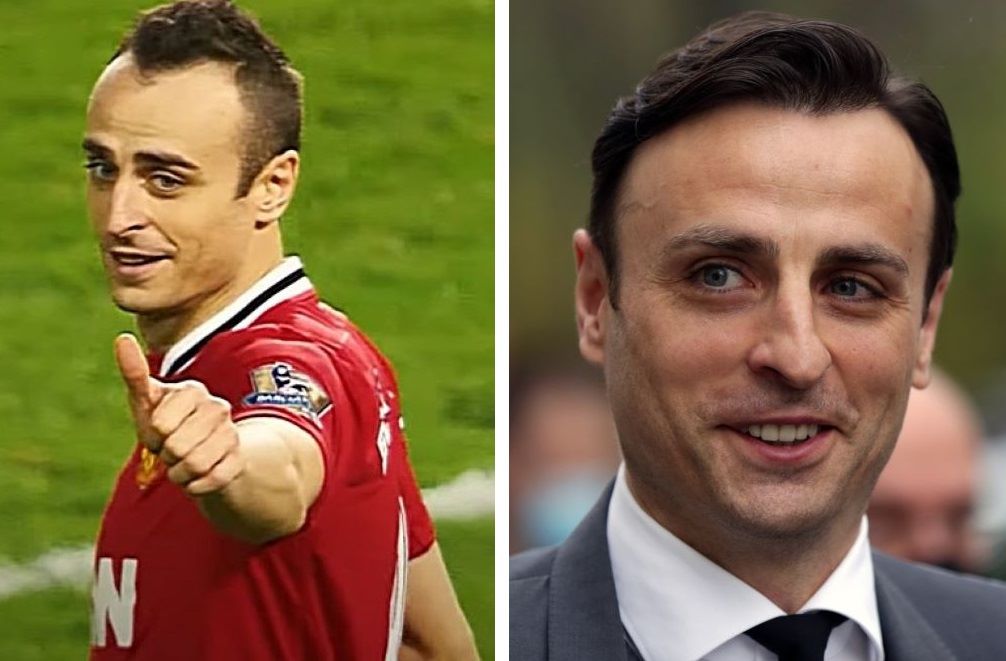 Dimitar Berbatov hairline in 2018 (left) and in 2021 (right)