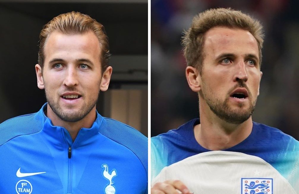 Harry Kane in 2017 (left) and in 2022 (right)