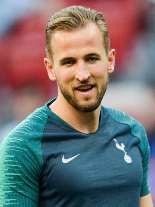 Harry Kane with balding on one side of head