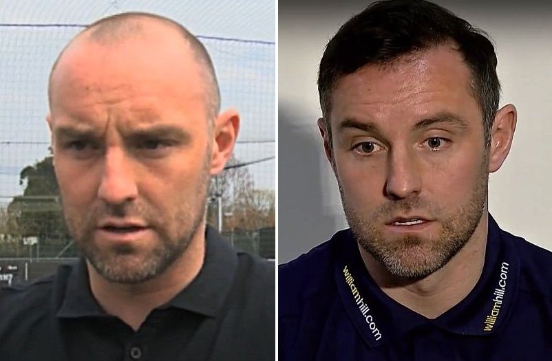 Kris Boyd hair transplant