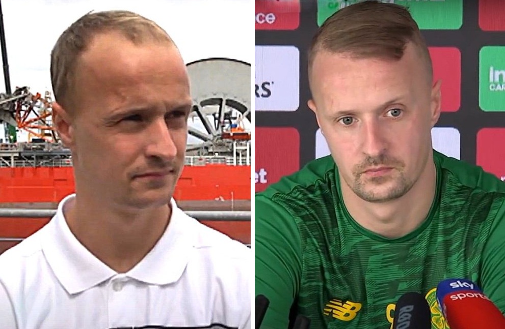 Leigh Griffiths hair transplant