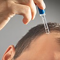 Minoxidil For A Receding Hairline: Benefits, Risks, Results