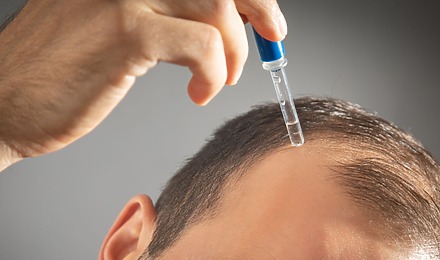 Minoxidil For A Receding Hairline: Benefits, Risks, Results