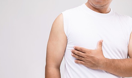 Finasteride Gynecomastia