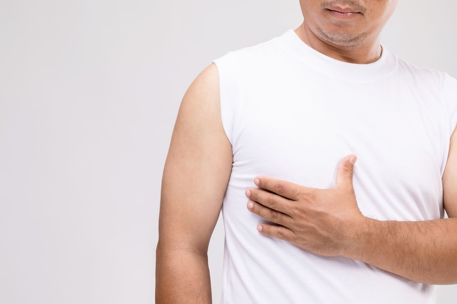 Finasteride Gynecomastia