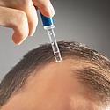 Minoxidil For A Receding Hairline: Benefits, Risks, Results