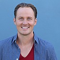 How Much Does A Receding Hairline Transplant Cost?