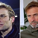 Jurgen Klopp Hair Transplant: Everything You Need To Know