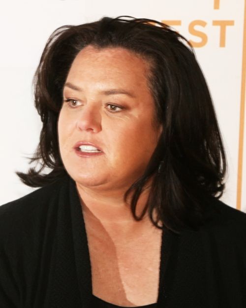 Rosie O’Donnell’s hairline