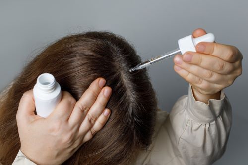 Woman applying topical Minoxidil to treat female hair loss