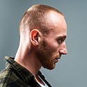 Norwood Stage 4: Photos, Treatments, Results