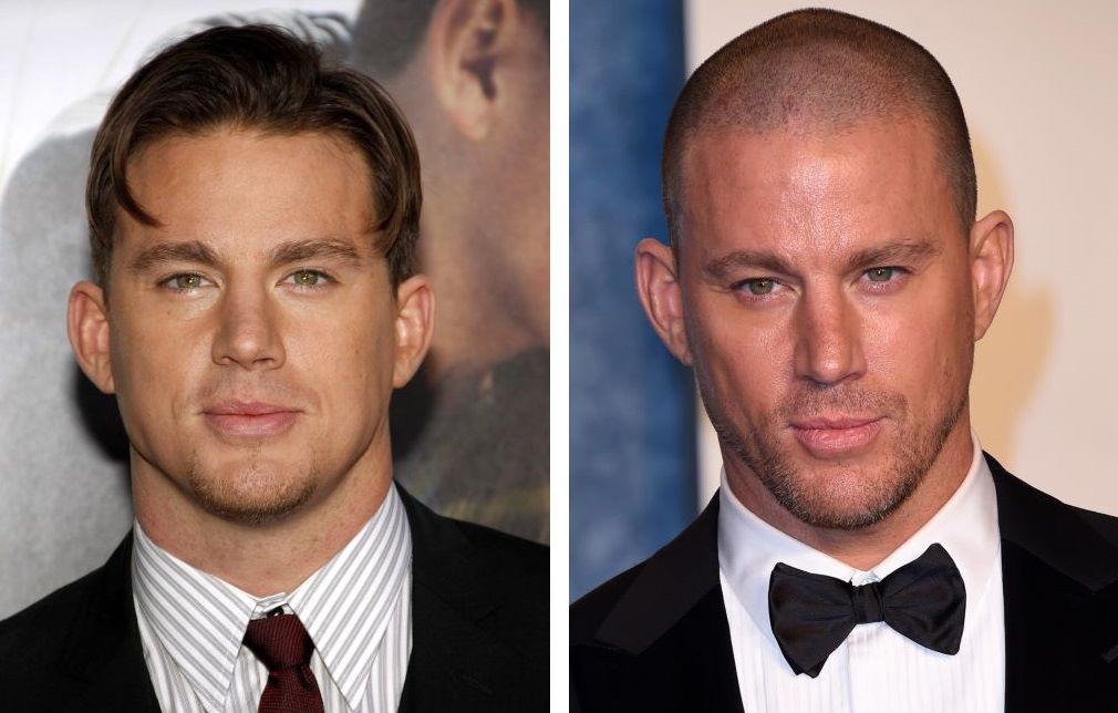 Channing Tatum with hair (left) and bald (right)