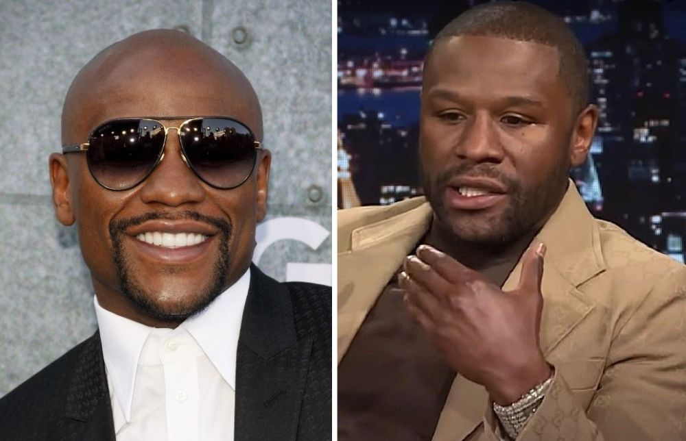 Floyd Mayweather bald in 2015 (left) and with hair in 2025 (right)