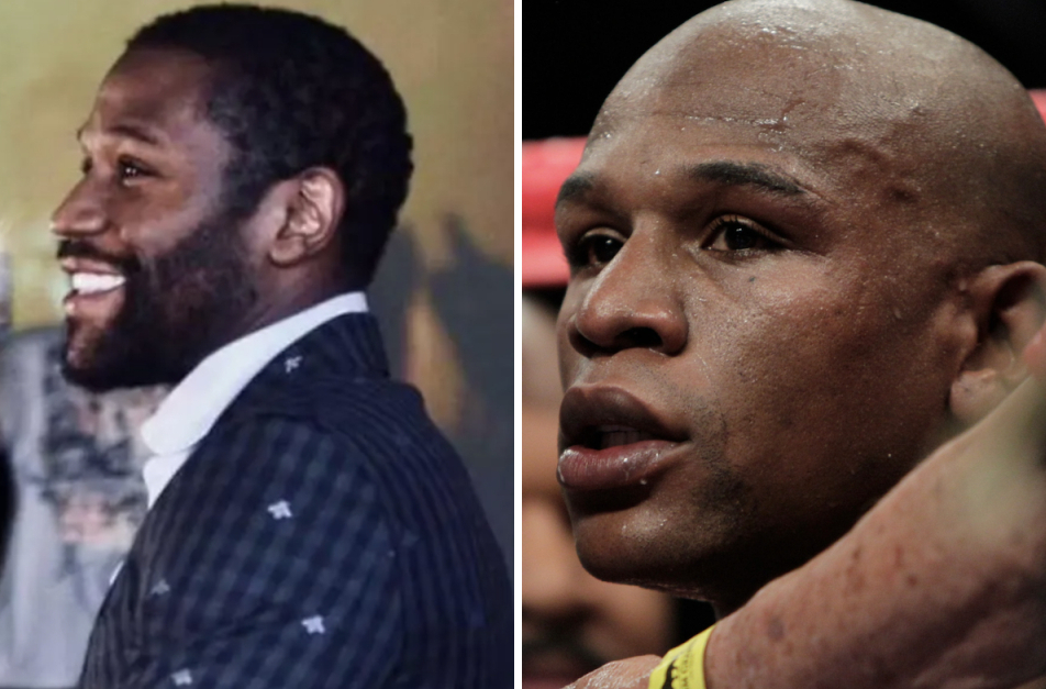 Floyd Mayweather with hair (left) and bald (right)