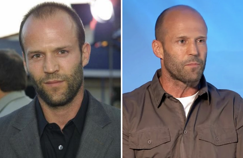 jason statham thinning hair (left) and bald with stubble (right)