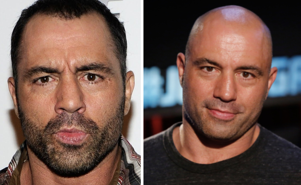 Joe Rogan with hair (left) and bald (right)