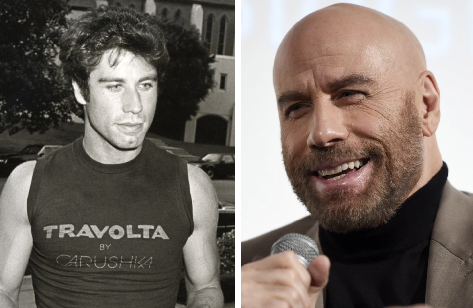Young John Travolta with hair (left) and bald (right)