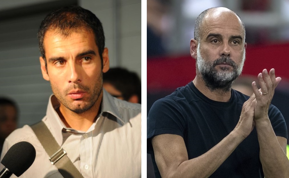 Pep Guardiola with hair (left) and bald (right)