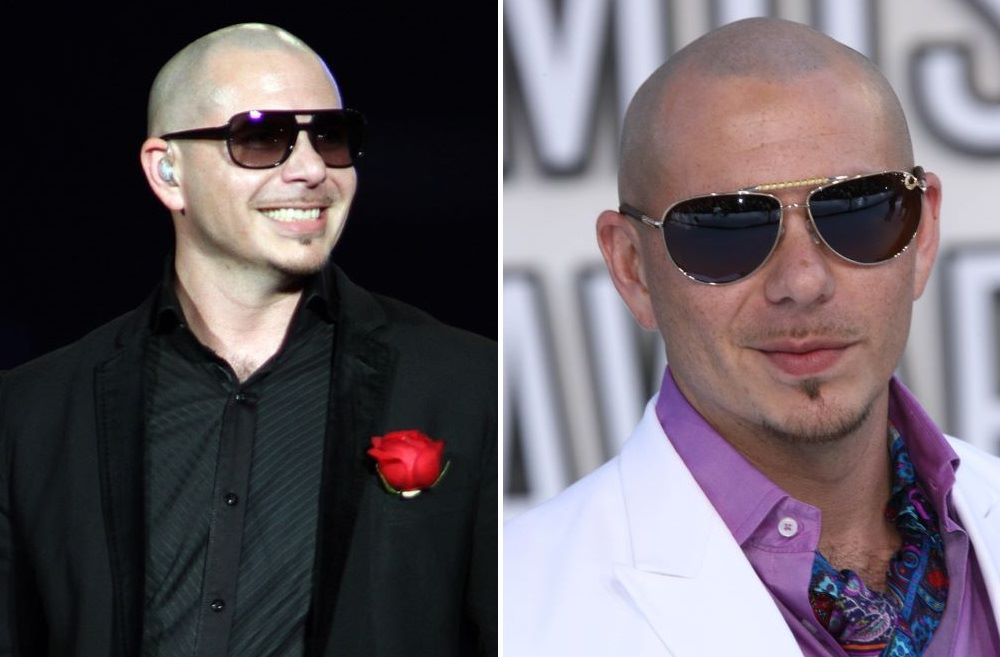 Pitbull with shaved head