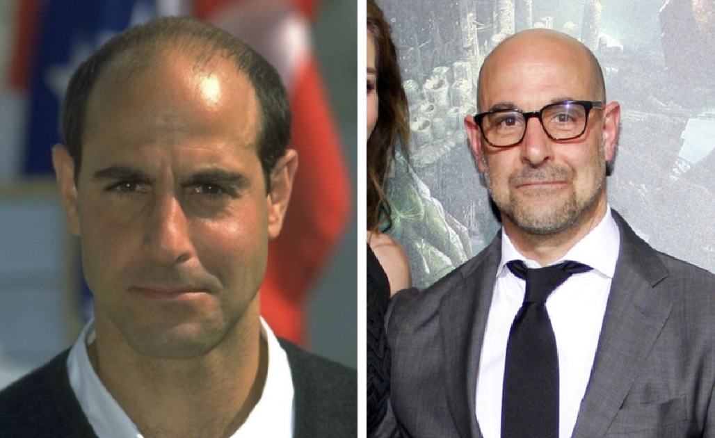 Stanley Tucci bald