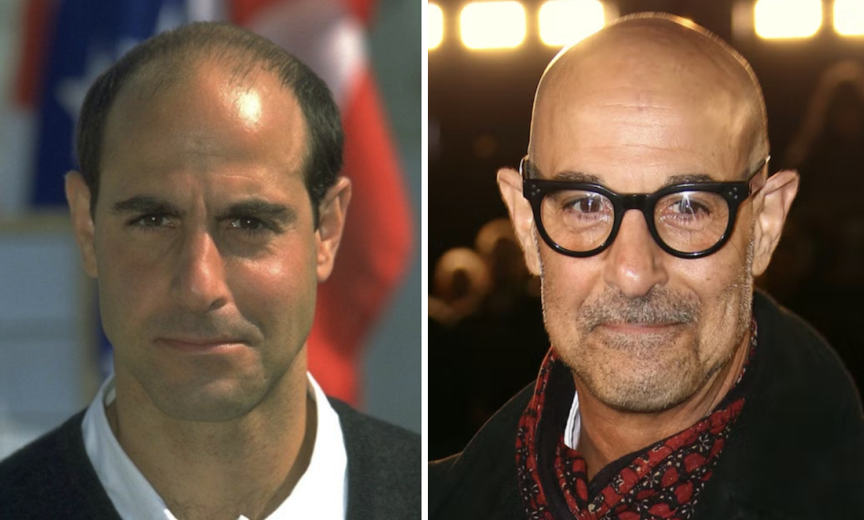 bald Stanley Tucci