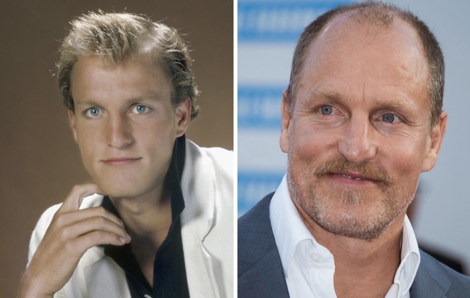 Woody Harrelson with hair (left) and with shaved head (right)