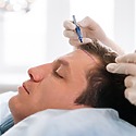 How To Fix Your Hairline: 9 Ways To Get It Back On Track
